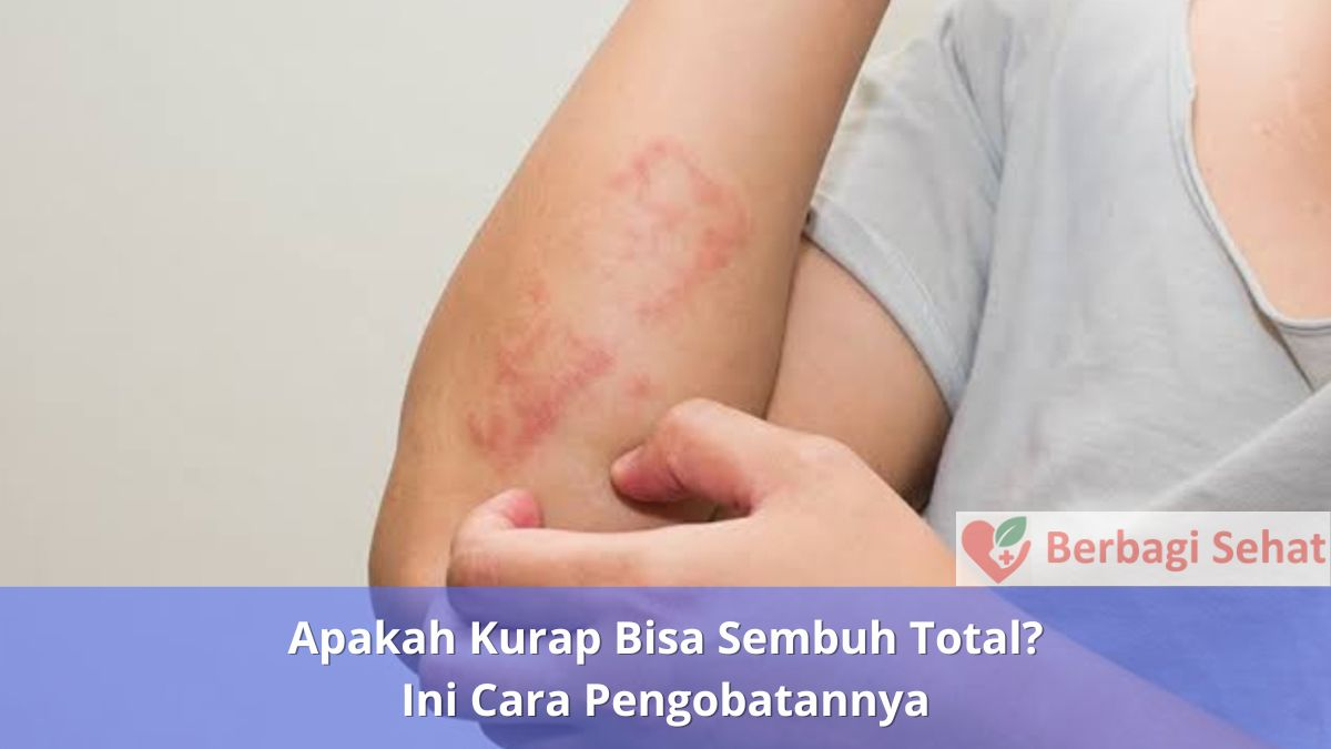 Apakah Kurap Bisa Sembuh Total Ini Cara Pengobatannya