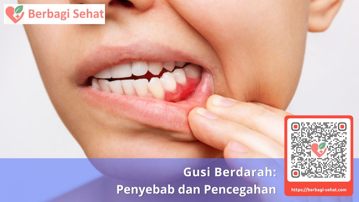 Gusi Berdarah Penyebab dan Pencegahan