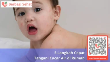 5 Langkah Cepat Tangani Cacar Air di Rumah