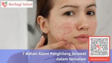 7 Bahan Alami Penghilang Jerawat dalam Semalam