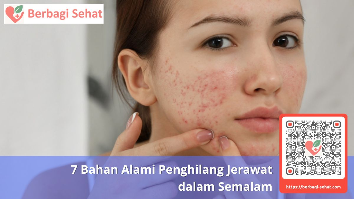 7 Bahan Alami Penghilang Jerawat dalam Semalam